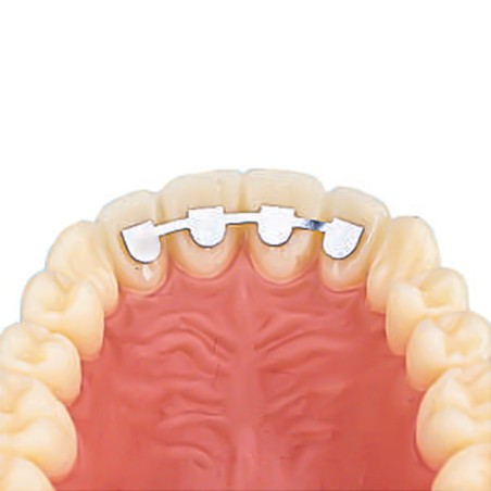 DB RETAINER KIT UPPER LAT/LAT